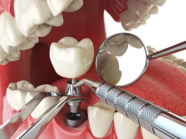 Best Emergency Orthodontic Repairs in Worland, WY